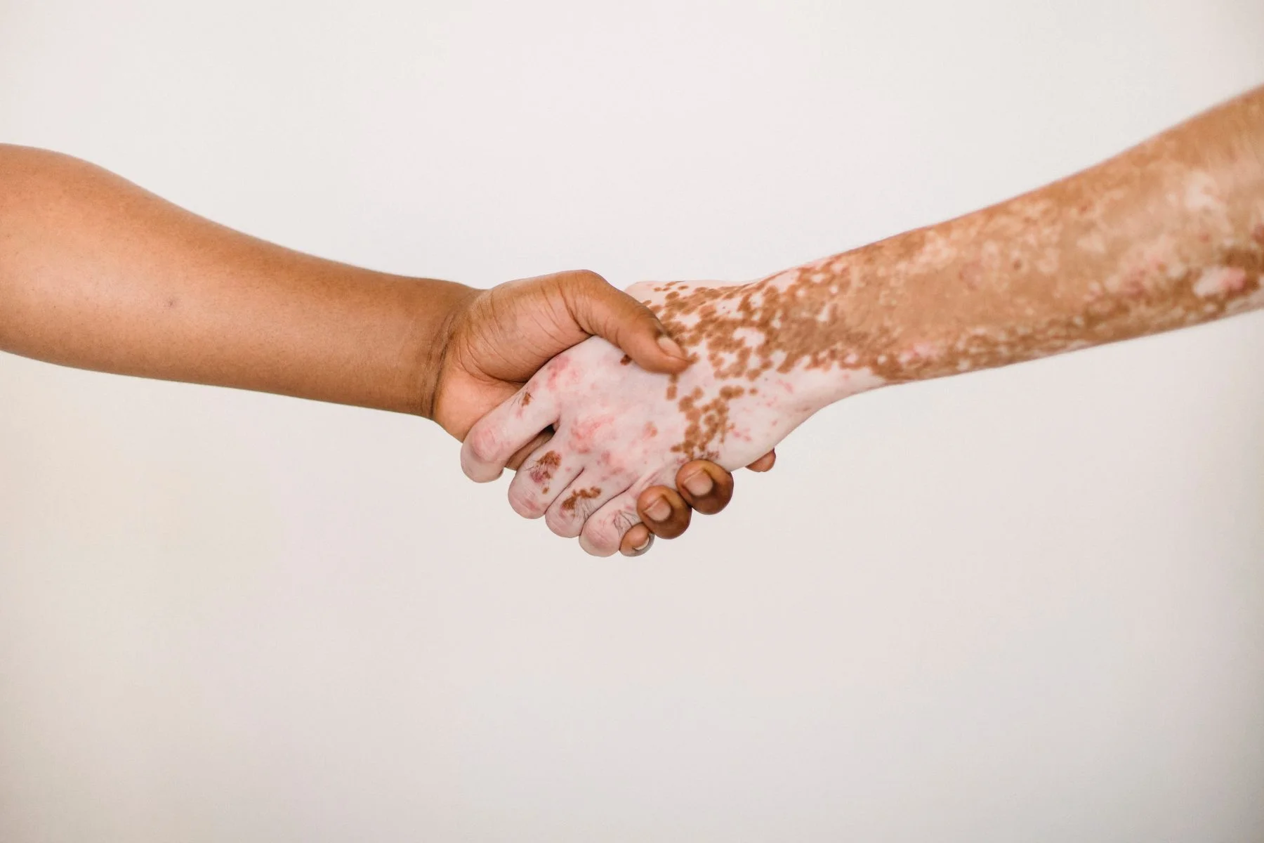 Codependency Inpatient Treatment